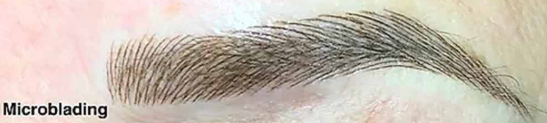 Après - Microblading
